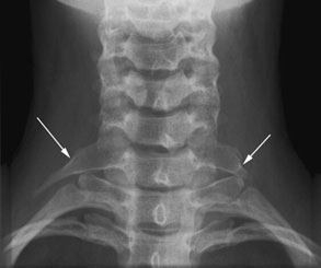 Figura 4: Aspect radiografic / Poziționare (Clark Ed. 12)