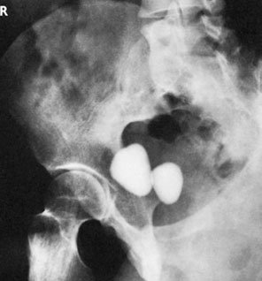 Figura 4: Aspect radiografic / Poziționare (Clark Ed. 12)