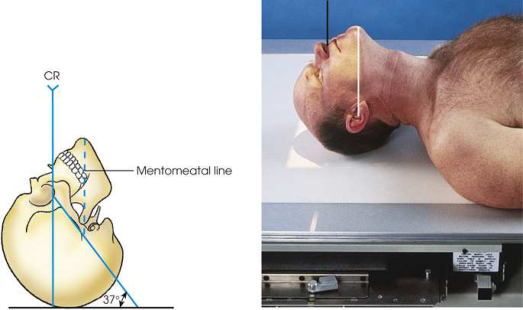 Merrill — pagina 910, imaginea 1