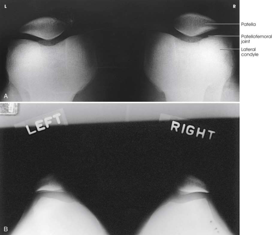 Merrill — pagina 572, imaginea 3